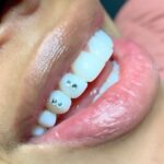 Swarovski Tooth Gem