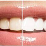 Beluxuri Ultra White